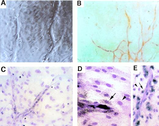 Fig. 1. Spatial relationship between uPA-expressing cells and PAI-expressing cells during capillary sprouting in vitro. Cultured rat aortic ring explants, displaying branching capillary-like sprouts, are shown 3 weeks after initial culture. (A) A phase-contrasted micrograph showing the tips of sprouts and the preformed monolayer through which sprouts extend. (B) Immunostaining with vWF antibodies. vWF-positive cells are organized in cords, indicating that all cells seen as surrounding the cords in (A) and (C through E) are nonendothelial cells. (C) In situ hybridization with a uPA-specific probe. Note that expressing cells are endothelial cells forming the cords. (D and E) In situ hybidization with a PAI-1–specific probe. Note that strongest hybridization signals are in cells closest to cords (highlighted by arrows) and that fibroblasts residing more distally show much weaker hybridization (arrowheads). Magnification: (A, C, and E) ×200 original magnification; (B) ×100 original magnification; (D) ×300 original magnification.
