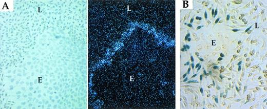 Fig. 4. Apposition-dependent regulation of PAI-1 is unaffected by inhibitors of the PA system and effectors of latent TGF-β activation. (A) In situ hybridization of L-fibroblast cells (L)/LE-II endothelial cells (E) grown in the presence of 100 mmol/L mannose-6-phosphate (brightfield, left and darkfield, right). (B) β-Gal activity in fibroblasts (L) transfected with a PAI promoter-LacZ plasmid and cocultured with LE-II cells (E) in the presence of 200 mg/mL Soybean Trypsin Inhibitor.