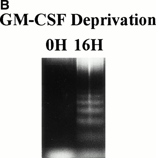 Fig. 1. Effect of GM-CSF deprivation on cell cycle distribution and apoptosis of TF-1 AML cells. TF-1 AML cells (3 × 105cells/mL) were cultured for 2 days in the presence of GM-CSF (1 ng/mL), washed three times with PBS, and resuspended in fresh media without GM-CSF. (A) Cell cycle profile was determined by PI staining and flow cytometric analysis at 0, 2, 4, 8, and 16 hours after GM-CSF deprivation. (B) Apoptosis of TF-1 cells before and 16 hours after deprivation of GM-CSF was analyzed by DNA fragmentation.
