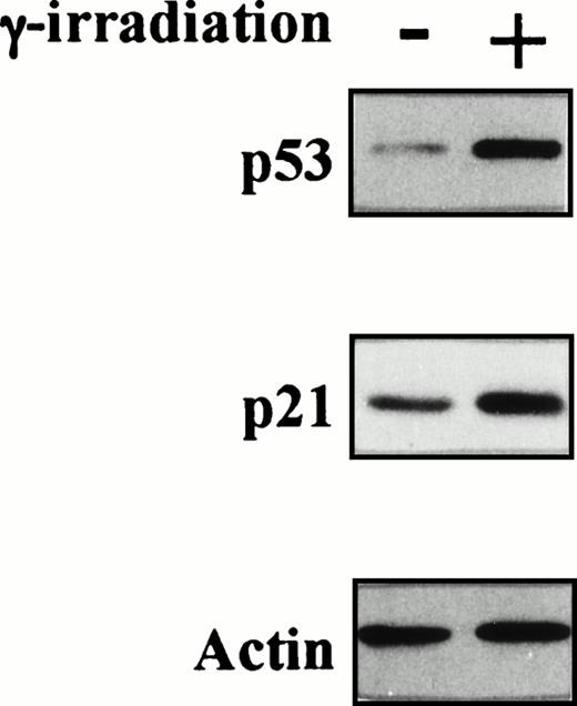 Fig. 4. Status of p53 in TF-1 AML cells. Amplicons from exon IV to exon IX of the p53 gene were obtained by PCR from genomic DNA of TF-1 AML cells, and the DNA was directly sequenced using appropriate sequencing primers. (A) The upper panel shows the wtp53 sequence of TF-1 cells, and the lower panel shows a 1 bp deletion at codon 251 in exon VI (ATC∅︀AC). (B) TF-1 cells were cultured for 2 days in fresh media with GM-CSF (1 ng/mL). After exposure to γ-irradiation (mock or 2.0 Gy), cells were cultured for an additional 2 hours or 16 hours . Total cell lysates from 5 × 106 viable cells/sample were immunoprecipitated with anti-p53 MoAb after 2 hours of culture and immunoblotted with horseradish peroxidase conjugated p53 MoAb. Similarly, cell lysates were immunoprecipitated with anti-p21 MoAb after 16 hours of culture and immunoblotted with anti-p21 MoAb. Equal protein loading was confirmed by IP and WB for actin. {/ANNT;4224n;;2112n;2112n}A {/ANNT;4224n;;2112n;124256n}B