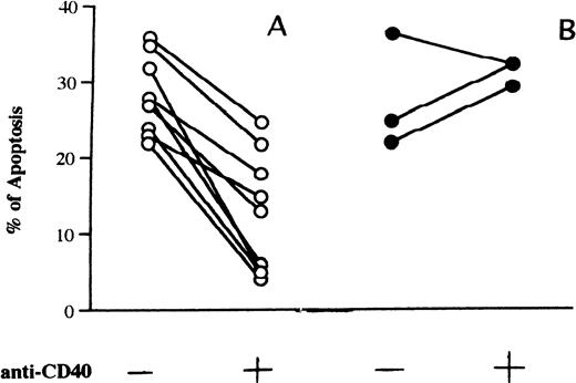 Fig. 1. (A) Inhibition of fludarabine-induced apoptosis by the anti-CD40 MoAb G28-5. (B) Samples with no response or only low response to anti-CD40 MoAb. Cells (1 × 106/mL) from patients with B-CLL were incubated in 10% FCS-RPMI 1640 medium with fludarabine (0.8 μg/mL) and in the absence or presence of MoAb G28-5 (ascites, 1:1000). After 3 days of cell culture the percentages of apoptosis were calculated. Any experimental point has been performed in duplicate; standard deviations of the mean apoptosis values were less than 10%. The levels of apoptosis in cells incubated without fludarabine, either in the presence or the absence of anti-CD40 MoAb, were less than 10%.