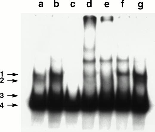 Fig. 3. Analyses of NF-κB/Rel nuclear complexes in B-CLL cells. A nuclear extract was obtained from B-CLL cells and incubated with a32P-labeled κB oligonucleotide, in the absence (a) or presence of a 50× molar excess of unlabeled AP1 oligonucleotide (b), a 50× molar excess of unlabeled κB oligonucleotide (c), anti-p50 (d), -RelA (e), –c-Rel (f), or preimmune (g) serum.