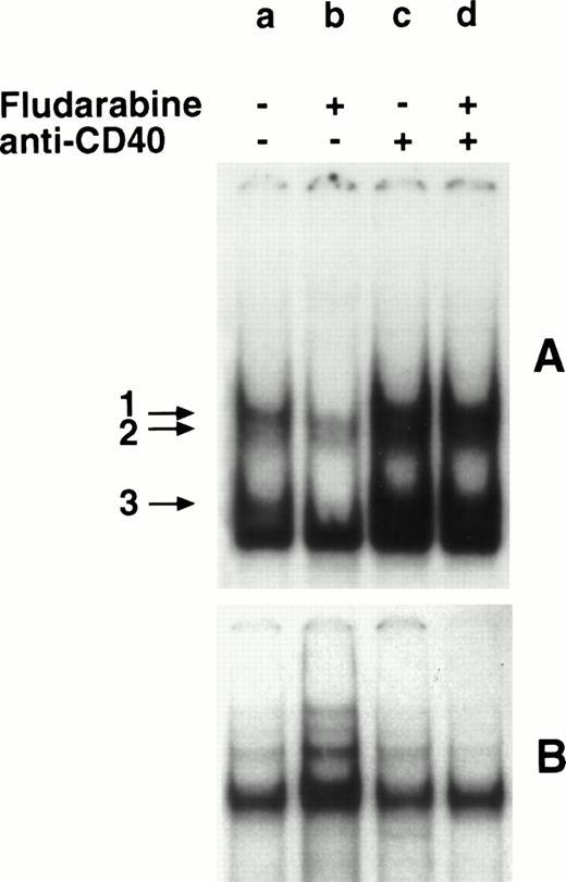 Fig. 4. Effect of fludarabine and anti-CD40 MoAb on NF-κB/Rel nuclear complexes. B-CLL cells (1 × 106/mL) were incubated in 10% FCS-RPMI 1640 medium, in the absence (a) or presence of fludarabine (0.8 μg/mL) (b), MoAb G28-5 (10 μg/mL) (c), or MoAb G28-5 + fludarabine (d). After 20 hours, nuclear extracts were obtained and incubated with a 32P-labeled κB (A) or SP-1 (B) oligonucleotide. The DNA-protein complexes were analyzed by EMSA. The SP1-normalized integrated O.D. (×10−2) (see Materials and Methods) of the bands 1 + 2 were: a, 1.1; b, 0.2; c, 3.9; d, 2.7.
