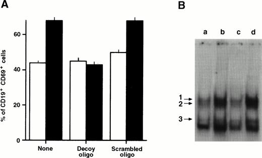 Fig. 5. Effect of a κB decoy oligonucleotide on CD69 expression (A) and the levels of NF-κB/Rel nuclear complexes (B) in CD40-stimulated B-CLL cells. (A) B-CLL cells (1 × 106/mL) were stimulated with anti-CD40 MoAb (10 μg/mL) in the absence or the presence of the 5-μmol/L κB decoy or scrambled oligonucleotide. After 3 days the cells were collected, washed, incubated with CD69 PE and CD19 FITC, and analyzed by FACScan. The proportion of the CD19+ cells in the different cultures was 74.8 ± 2.4. (□), Medium; (▪), anti-CD40 MoAb. (B) B-CLL cells (1 × 106/mL) were incubated in 10% FCS-RPMI 1640 medium (a), and with anti-CD40 MoAb (10 μg/mL) in the absence (b) or presence of the 5-μmol/L κB decoy (c) or scrambled (d) oligonucleotide. After 20 hours, nuclear extracts were obtained and incubated with the 32P-labeled κB oligonucleotide. The DNA-protein complexes were analyzed by EMSA.