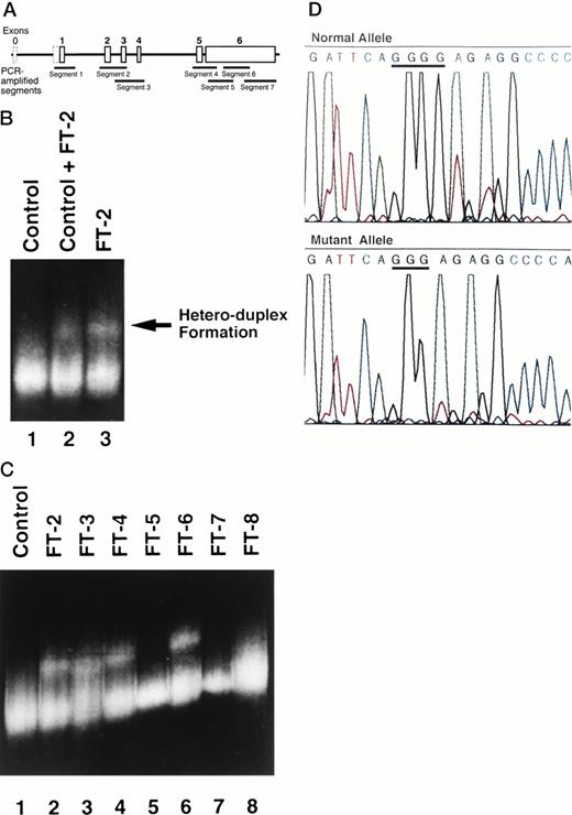 Fig. 2. (A) A scheme of the genomic structure of TPO.According to GenBank accession no. D32046.10 Exon 0 (dashed box) corresponds to exon 1 of Chang et al.14In this reference, the initiation codon is located in exon 2. TheTPO genome was divided and amplified by nested PCR. Each PCR segment spans as described below: segment 1, from nucleotide (nt) 1240 to nt 1600; segment 2, from nt 3100 to nt 3696; segment 3, from nt 3626 to nt 4066; segment 4, from nt 5959 to nt 6440; segment 5, from nt 6390 to nt 6778; segment 6 from nt 6682 to nt 7071; and segment 7, from nt 6954 to nt 7545. (B) Hetero-duplex formation by amplified segment 2 PCR products. Hetero-duplex bands are indicated by an arrow. Lane 1, PCR products from a healthy volunteer alone as a control; lane 2, mixture of PCR products from FT-2 and control; and lane 3, PCR products from FT-2 alone. (C) Hetero-duplex analysis of segment 2 of all family members, except for FT-1. All of the ET-affected members display the hetero-duplex bands (FT-2, 3, 4, and 6). However, none of the healthy family members showed hetero-duplex formation in segment 2 (FT-5, 7, and 8). (D) Identification of the mutation in the segment 2 ofTPO gene. The upper panel shows the DNA sequence of wild-type allele, and the lower panel shows the mutant allele.