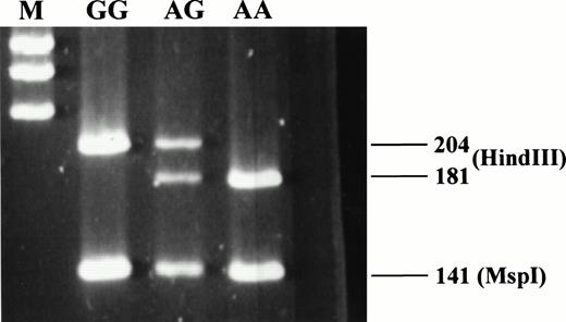 Fig. 1. Detection of factor II G20210A polymorphism: homozygote AA, heterozygote GA, and homozygous normal GG. Note the constant fragment obtained by Msp I digestion. The marker (M), anAlu-digested pBR322, was used as a molecular weight standard. Numbers on the right of the gel indicate the size (in basepairs) of the bands.