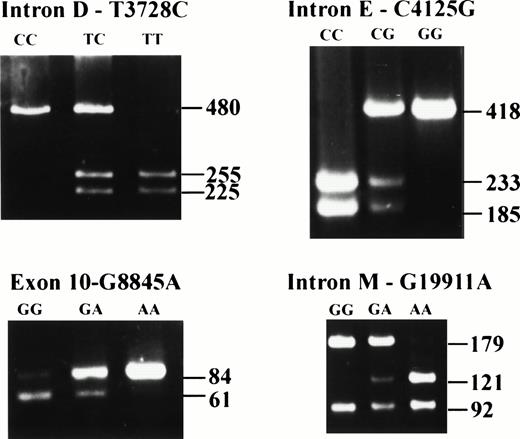 Fig. 2. Allele-specific restriction analysis of four dimorpohic markers in the factor II gene. The 3 possible genotypes for each polymorphism are illustrated. The size (in basepairs) of the bands is depicted.