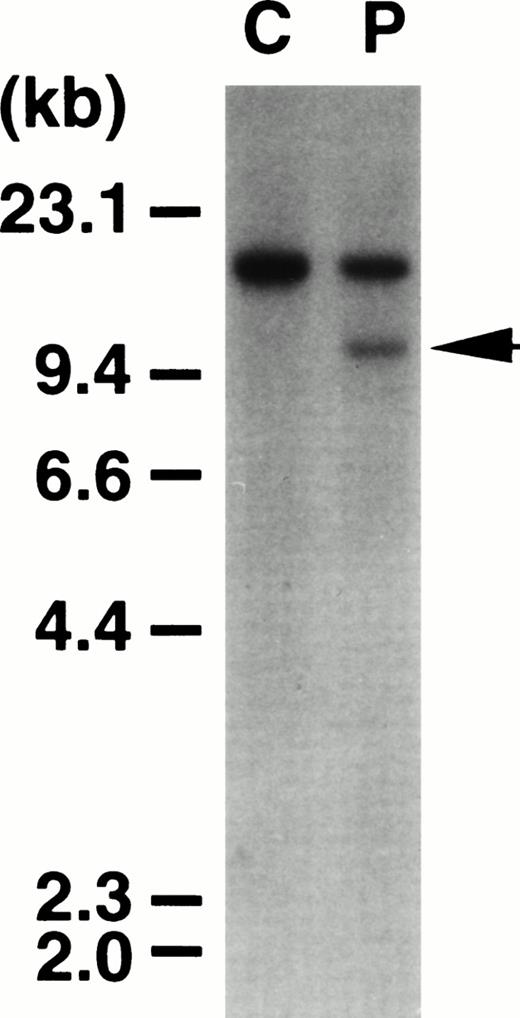 Fig. 1. Southern blot of DNA digested with HindIII and probed with the 0.9-kb fragment of the MLL gene. C, normal peripheral lymphocytes. P, leukemic cells from the patient. The patient exhibited a rearranged band (arrowhead) with this probe.