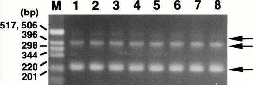 Fig. 4. Expression of the ABI-1 in normal peripheral blood by RT-PCR analysis. Total RNAs isolated from peripheral blood of 8 healthy volunteers were used as the cDNA template. M, size marker (1-kb DNA ladder; GIBCO BRL, Gaithersburg, MD). Arrows indicate the amplified bands.