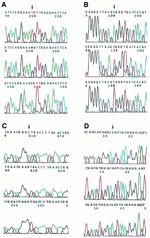 Fig. 4. Automated DNA sequence analysis of PCR products from four APL cases with single nucleotide changes. The upper panels show bi-allelic sequencing results for the pretreatment samples, which contain normal signals as indicated by the arrows in (A), (B), and (C), whereas (D) demonstrates a heterozygous pattern. The middle panels show heterozygous bi-allelic signals for the corresponding relapse samples. The lower panels show the results of nested, PML-RAR allele-specific amplification of PCR products from the relapse cases. (A) Case no. 9, T→C (Met→Thr). (B) Case no. 17, C→T (Arg→Trp). (C) Case no. 14, C→G (Leu→Val). (D) Case no. 2, C→T in 3′-UT region (illustrated from antisense strand sequence analysis, ie, shown as G→A; in the upper panel the heterozygotic mutant A appears on the shoulder of the normal G).