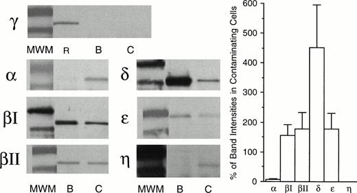 Fig. 1. Expression of PKC isozymes in basophils and contaminating cells. Basophils (purity: 98% to 99.4%) and contaminating cells (lymphocytes and monocytes) were lysed and subjected to Western blot analysis as described in Material and Methods. (MWM) Molecular weight marker (upper band: 97.4 kD, lower band: 68 kD). (R) Rat brain extract. (B) Human basophils. (C) Contaminating cells (lymphocytes and monocytes). The blots are representative of five experiments for PKC and δ and, three experiments for the other isozymes. The band intensities were quantified by digital imaging. The data are expressed as the amount of each isozyme present in basophils expressed as a percent of the amount in contaminating cells (right panel). The data represent the mean ± SEM.