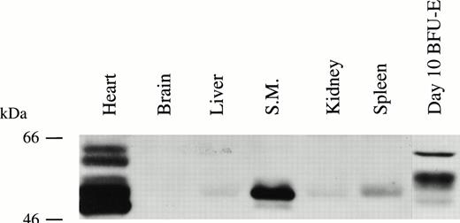Fig. 5. Bcl-3 is expressed in many human tissues. Protein extracts from normal human tissues were prepared as described in the Materials and Methods. Thirty micrograms of protein was loaded on each lane of a 10% polyacrylamide gel and detection was with anti–Bcl-3 antibody.