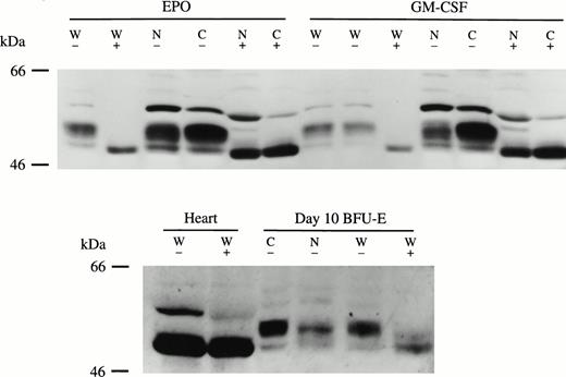 Fig. 6. Bcl-3 is hyperphosphorylated in TF-1 cells and BFU-E–derived erythroblasts. (Top) Whole cell lysates (W) and nuclear (N) and cytoplasmic (C) extracts were prepared from Epo-induced or GM-CSF–induced TF-1 cells. Thirty micrograms of each extract was incubated with or without 26 U of CIP at 37°C for 40 minutes and then subjected to Western blotting assay with anti–Bcl-3 antibody and ECL. (Bottom) Thirty micrograms of whole cell lysate (W) from normal human heart tissue or 50 μg from day-10 BFU-E–derived erythroblasts was also incubated with or without 26 U CIP and subjected to Western blotting with anti–Bcl-3 as described in the Materials and Methods. Three experiments were performed with similar results. (+) with CIP; (−) without CIP.