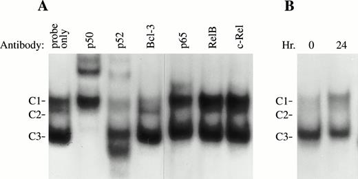 Fig. 8. Bcl-3 is associated with NF-κB p52 in TF-1 cells (EMSA). (A) Six micrograms of nuclear extracts prepared from TF-1 cells stimulated with GM-CSF for 24 hours was incubated with different NF-κB antibodies for 10 minutes before adding a32P-labeled c-myb κB binding oligonuclear probe. Three DNA-protein complexes were generated. Complexes 2 and 3 (C2 and C3) were supershifted by anti-p50; C1, C2, and C3 were shifted by anti-p52. C1 was reproducibly inhibited by anti–Bcl-3 antibody (with a long exposure, a supershifted band was also visible). However, anti-RelB and anti–c-Rel had no effect on any of these complexes. Similar results were observed in 3 experiments. (B) EMSA was performed with growth factor-deprived TF-1 cells or TF-1 cells induced with GM-CSF for 24 hours. The C1 complex was greatly increased by GM-CSF stimulation, whereas other complexes had no significant change. This experiment was repeated 3 times with similar results.