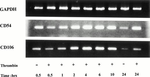 Fig. 3. Increased CD54 and CD106 mRNA steady-state levels in thrombin-activated HUVECs. PCR products of RNA prepared from HUVECs stimulated by 8 U/mL of thrombin for different times were deposited on a 2% agarose gel. ICAM-1 mRNA was detected in unstimulated cells but increased after 2 hours and remained high after 24 hours of thrombin stimulation. VCAM-1 mRNA was detected in unstimulated HUVECs, raised to a maximum level between 4 and 6 hours and then decreased until 24 hours.