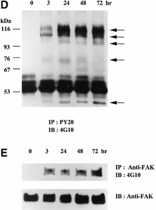 Fig. 1. TPA-induced differentiation of CMK cells on day course study. After addition of 20 nmol/L TPA to CMK cells, whole cell lysates were subjected to immunoblotting analyses with (A) anti-integrin IIb MoAb, (B) anti-integrin β3 MoAb, or (C) anti-Syk polyclonal antibody. In each lane, 30 μg protein of cell lysates was loaded. The cell lysates were next immunoprecipitated with (D) antiphosphotyrosine MoAb (PY20) or (E) anti-FAK polyclonal antibody. Immunoblotting analyses were performed with antiphosphotyrosine MoAb (4G10) as described in the Materials and Methods. In (D), arrows indicate the positions of the tyrosine-phosphorylated protein bands. In (E), the blots were stripped and reprobed with the anti-FAK polyclonal antibody. Results are representative of 3 experiments.