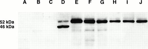 Fig. 3. Western blot analysis for BSAP in hematolymphoid tumor cell lines. (A) YT, (B) Jurkat, (C) K562, (D) PB-697, (E) Nalm-6, (F) Ramos, (G) Granta 519, (H) SU-DHL-5, (I) SU-DHL-6, and (J) NCEB 1806. A 52-kD band of expected size is demonstrated only in the B-cell lines (D through J). PB-697 and Nalm-6 also display a second band of 46 kD, which has a much lower intensity in Nalm-6. This band originates from a cytoplasmic cross-reactive protein that does not appear to be related to BSAP (see text).