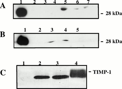 Fig. 4. Detection and functional analysis of TIMP-1. (A) Western blot analysis of unconcentrated TIMP-1 in conditioned media of various BL lines: lane 1, rTIMP-1 (300 ng) positive control; lane 2, JD38; lane 3, ST846; lane 4, Daudi; lane 5, AG876; lane 6, PA682; lane 7, DW6. JD38 cells were transfected with human timp-1 or emptyLXSN vector as described in the Materials and Methods. (B) Western blot analysis of TIMP-1 by TIMP-1–JD38 cell clones: lane 1, rTIMP-1 (300 ng) positive control; lane 2, parental JD38 cells; lane 3, TIMP-1–JD38 cell clone 20; lane 4, TIMP-1–JD38 cell clone 24; lane 5, LXSN-JD38 cells. (C) Reverse zymogram of TIMP-1 in the concentrated conditioned media of transfected JD38 cells: lane 1, LXSN-JD38 cells; lane 2, TIMP-1–JD38 cell clone 20; lane 3, TIMP-1–JD38 cell clone 24; lane 4, positive control HT1080 cells. Representative results of three independent analyses.