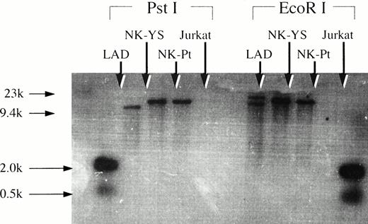 Fig. 7. Southern blotting analysis of genomic DNA extracted from NK-YS cells and fresh leukemic cells after restriction enzyme digestion using EcoRI and PstI with the EBV terminal repeat. EBV-transformed B lymphoblastoid cell line, LAD cells, and Jurkat cells were used for positive and negative controls, respectively. The NK-YS cells showed a monoclonal band of EBV terminal repeat identical to that of the fresh leukemic cells, but not identical to that of the LAD cells.