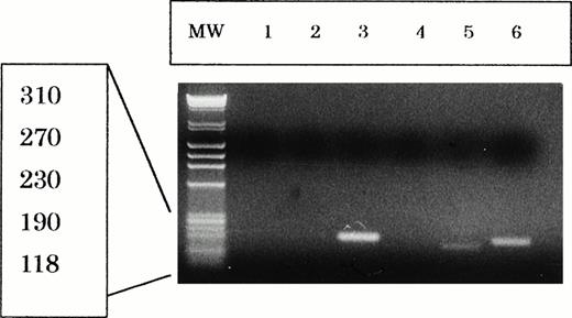 Fig. 9. Reverse transcription-PCR analysis of EBNA-2 and LMP-1 mRNA expression in Jurkat cells (lane 1 and 4), NK-YS cells (lane 2 and 5), and LAD cells (lane 3 and 6). Ten microliters of reaction solution was applied to each lane of gel. The LAD cells expressed both EBNA-2 (195 bp) and LMP-1 (160 bp) mRNA. NK-YS cells expressed a low level of LMP-1 (130 bp) mRNA with about 30 bp deletion, but no EBNA-2 mRNA. ø X174 HaeIII digest was electrophorased in the MW lane.