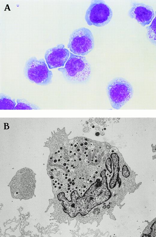 Fig. 2. Morphology of the novel human NK cell line of NK-YS (A) under light microscopy (May-Grünwald Giemsa staining, original magnification × 500) and (B) under electron microscopy (original magnification × 3,800). The NK-YS cells show LGL morphology identical to that of leukemic cells in the peripheral blood of the patient from whom the cell line was derived.