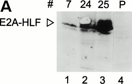 Fig. 1. Overexpression of E2A-HLF in M1p53tsvalcells. (A) Western blot analysis of 10 μg protein/lane blotted with HLF antisera showing variable levels of E2A-HLF expression in clones 7, 24, and 25 compared with a lack of expression in parental cells (P). (B) Nuclear lysates prepared from E2A-HLF clones 7, 24, and 25 and studied by EMSA using a 32P-labeled oligonucleotide probe containing the HLF consensus binding sequence and supershifted with an E2A antibody. Supershifted complexes containing E2A-HLF were stable at both 0 hours (mutant conformation of p53 at 37°C) and 14 hours after a shift in temperature (wild-type conformation of p53 at 32°C).