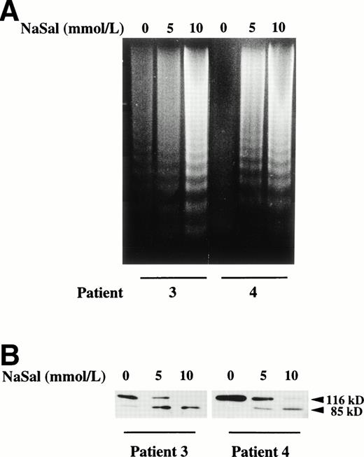 Fig. 5. Induction of apoptosis by salicylate on B-CLL cells. (A) Effect of salicylate on DNA fragmentation in B-CLL cells. Cells from patients no. 3 and 4 were incubated for 24 hours with 5 and 10 mmol/L sodium salicylate (NaSal). DNA was extracted and subjected to agarose gel electrophoresis as described in the Materials and Methods. (B) Effect of salicylate on PARP cleavage. Cells from patients no. 3 and 4 were incubated for 48 hours with 5 and 10 mmol/L sodium salicylate (NaSal). PARP cleavage was analyzed on protein extracts from these cells by Western blot as described in the Materials and Methods. The position of the native PARP (116 kD) and the proteolytic fragment (85 kD) is indicated.