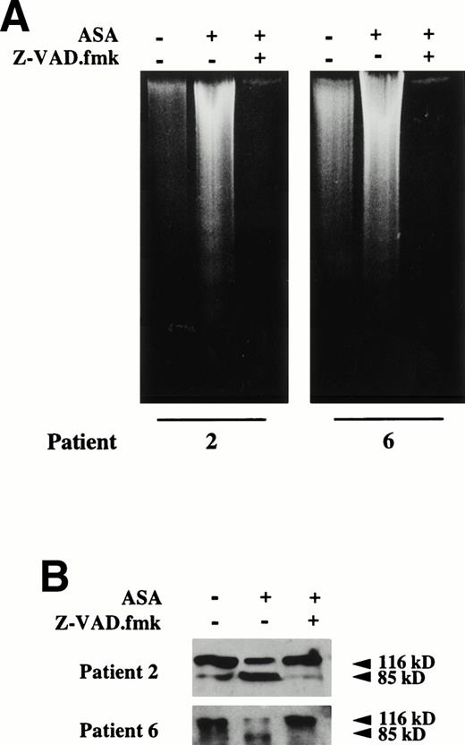 Fig. 7. Effect of the caspase inhibitor Z-VAD.fmk on aspirin-induced apoptosis in B-CLL cells. (A) Effect of Z-VAD.fmk on aspirin-induced DNA fragmentation. B lymphocytes from 2 B-CLL patients were incubated for 24 hours with 10 mmol/L aspirin (ASA) in the presence or absence of 200 μmol/L Z-VAD.fmk. DNA was extracted and subjected to agarose gel electrophoresis as described in the Materials and Methods. (B) Effect of Z-VAD.fmk on aspirin-induced PARP cleavage. Cells from patients no. 2 and 6 were incubated for 24 hours with 10 mmol/L aspirin (ASA) in the presence or absence of 200 μmol/L Z-VAD.fmk. Cells were lysed and analyzed by Western blot as described in the Materials and Methods. Z-VAD.fmk was added 1 hour before aspirin administration.