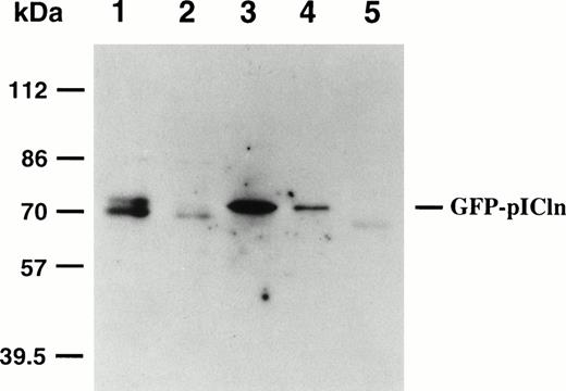 Fig. 5. Interaction between GFP-pICln and GST/P4.1 proteins. SiHa cells were electroporated with a GFP-pICln cDNA. The whole cell lysates prepared from transfected cells (lane 1) were incubated with GST/P80 (lane 3), GST/P30 (lane 4), or GST/P10+24 (lane 5) fusion proteins previously coupled to glutathione sepharose beads. The bound complexes were electrophoresed, transferred to the membrane, and analyzed by a polyclonal antibody against GFP. Lane 2 is a negative control. The cell lysate was prepared from nontransfected SiHa cells and analyzed by anti-GFP antibody.