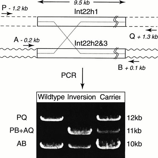 Fig. 1. Schematic of the PCR assay. The four primers (P, Q, A, and B) are represented by arrows and their positions are indicated. The upper box represents int22h1, and the dashed lines indicate flanking sequences. The lower box represents int22h2 andint22h3, and the wavy lines indicate the flanking sequences. Deleterious inversions can occur by recombination betweenint22h1 and either int22h2 or int22h3 (dotted lines). Amplified products in male patients with the wild-type and the inverted factor VIII genes and a carrier female. PCR was performed in 25 μL with 250 ng of genomic DNA, a mixture containing 50 mmol/L Tris.HCl, pH 9.2, 2.25 mmol/L MgCl2, 7.5% DMSO, 16 mmol/L (NH4)2SO4, 250 mmol/L each of dGTP and deaza-dGTP, 500 mmol/L of the other dNTPs, and 3.3 U of Expand Long Template DNA polymerases (Boehringer Mannheim, Mannheim, Germany). After 2 minutes of denaturation at 94°C, 30 cycles were performed at 94°C for 12 seconds, 65°C for 30 seconds, and 68°C for 12 minutes for 10 cycles, (the remaining 20 cycles were performed for 12 minutes with 20 more seconds for each additional cycle). The primers used are as follows: P = GCC CTG CCTG TCC ATT ACA CTG AT GAC ATT ATG CTG AC; Q = GGC CCT ACA ACC ATT CTG CCT TTC ACT TTC AGT GCA ATA; A = CAC AAG GGG GAA GAG TGT GAG GGT GTG GGA TAA GAA; B = CCC CAA ACT ATA ACC AGC ACC TTG AAC TTA CCC TCT. Primer concentrations were 0.4, 0.4, 0.12, and 0.12 μmol/L, respectively.