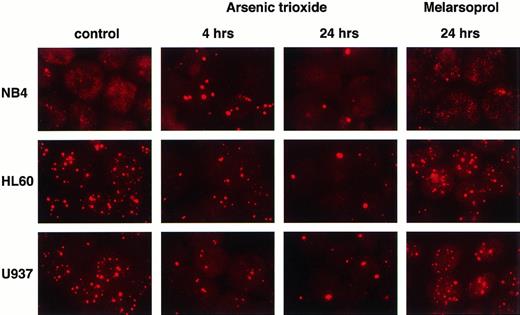 Fig. 4. PML relocalization and degradation in APL or non-APL cell lines after As2O3 and melarsoprol treatment. As2O3 induces PML relocalization onto nuclear bodies, followed by PML degradation not only in NB4 cells but also in HL60 and U937 cell lines. Melarsoprol does not affect PML nuclear localization.