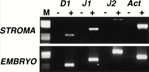 Fig. 1. Expression of Notch ligands in primary mouse stromal cell cultures. RT-PCR analysis of Delta 1 (D1), Jagged 1 (J1), and Jagged 2 (J2) mRNAs in primary murine stromal cell culture. RT-PCR was performed on cultures that contained no visible hematopoietic elements (top panel) and on day 13.5 mouse embryo RNA (bottom panel), with (+) or without (−) reverse transcription. Products were analyzed on a 2% agarose gel. Lane M contains a pBR322 HaeIII marker (Sigma), the visible fragment sizes are 587, 540, 504, 458, 434, 267, 234, 213, 192, and 184 bp. All RT-PCR products were of the predicted size and their identity was further confirmed by sequencing.