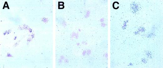 Fig. 2. In situ hybridization for Jagged 1 in mouse stromal cell cultures. Radioactive in situ hybridization of primary mouse stromal cell cultures prepared as described in the text. The probe is visualized by grain deposition in the emulsion layer overlying the cells, which have been counterstained with nuclear fast red. (A) Positive control anti-sense actin probe, 1 week exposure. Grain deposition over cells in excess of background indicates RNA is intact. (B) Negative control, sense Jagged 1 probe, 3-week exposure. Grain deposition over cells is not increased over background, indicating no nonspecific hybridization of control probe. (C) Experimental sample, Jagged 1 anti-sense probe, 3-week exposure. Grain deposition over cells indicates Jagged 1 RNA is transcribed by the majority of stromal cells.