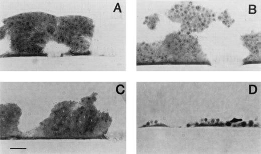 Fig. 2. Representative light micrographs of blood-collagen interactions. The surface was exposed at a shear rate of 2,600 s−1 during 3 minutes to nonanticoagulated blood drawn from volunteers given either placebo (A), aspirin (B), ticlopidine (C), or the combination of both (D). The sections were prepared perpendicular to the direction of the blood flow. Note that the collagen coat is not visible because the staining procedure does not contrast the fibrils. Original magnification × 1,000. Bar represents 10 μm.
