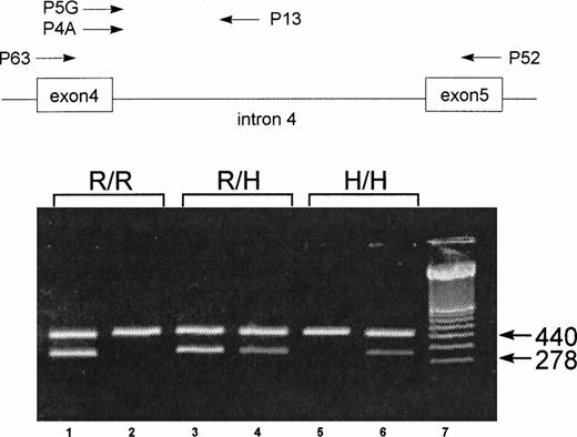 Fig. 1. Schematic illustration of the localization of the primers for the nested SSP-PCR and representative results of FcγRIIa genotype of three individuals: homozygous FcγRIIa-R/R131 (R/R), heterozygous FcγRIIa-R/H131 (R/H), and homozygous FcγRIIa-H/H131 (H/H). For the FcγRIIa-specific amplification, primers P63 and P52 were used.27 For the allele-specific amplification, primers P5G (for the FcγRIIa-R131 allele) and P4A (for the FcγRIIa-H131 allele) were combined with a common antisense primer, P13. The 440-bp amplification product of CRP was used as an internal control. The 278-bp fragment represents the allele-specific amplification product from the SSP-PCR of FcγRIIa. Amplification with P13 and P5G (lane 1) and with P13 and P4A (lane 2) shows a homozygous FcγRIIa-R/R131 individual. Amplification with P13 and P5G (lane 3) and with P13 and P4A (lane 4) shows a heterozygous FcγRIIa-R/H131 individual. Amplification with P13 and P5G (lane 5) and with P13 and P4A (lane 6) shows a homozygous FcγRIIa-H/H131 individual. Lane 7 contains a molecular weight standard (100 bp).