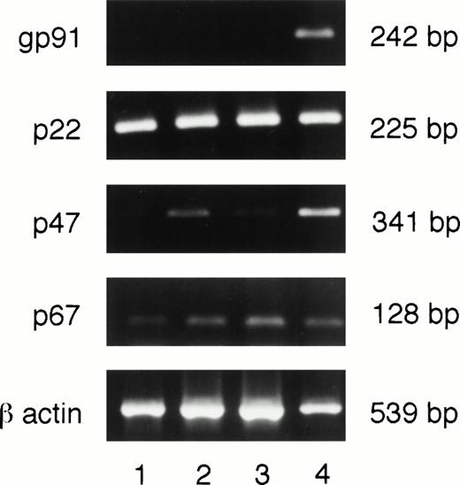 Fig. 5. Neutrophils deficient in PU.1 fail to transcribe the gp91phox gene. RNA was prepared, reverse transcribed, and subjected to PCR as described in Materials and Methods. These samples were obtained from 2-week cultures. All NADPH oxidase component subunits were detectable in one normal (lane 4) and three different PU.1-deficient cultured neutrophil samples (lanes 1 through 3) by this method except for gp91, which was only found in normal cells. Controls for amplification of DNA in the absence of reverse transcription for each reaction were negative; these data are not shown. bp, base pairs.