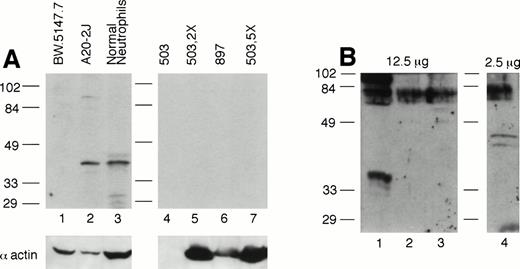 Fig. 7. PU.1 protein is detectable in normal neutrophils but not PU.1-deficient neutrophils. (A) Total protein prepared from cultured neutrophils was separated on a 10% SDS-polyacrylamide gel, blotted, and probed with an antibody directed against the C-terminus of PU.1 (Santa Cruz). Note PU.1 signal around 40 kD in 50 μg of extract from the B-cell line A20-2J (lane 2) and normal neutrophils (lane 3), but not in lanes 4 through 7 containing 50 μg (lanes 4 and 6), 100 μg (lane 5), and 250 μg (lane 7) from PU.1-deficient neutrophil cell lines (#503 and #897) derived from two different PU.1-null mice. Although lane 4 containing #503 did not react with the antiactin antibody, lanes 5 and 7 (containing a twofold and fivefold excess of the same extract) clearly reflect an excess of protein present and show no PU.1 signal. Lane 1 contains the T-cell line BW.5147.7 that does not express PU.1. (B) Nuclear protein, 2.5 to 12.5 μg, prepared from cultured cells was separated on a 12% SDS-polyacrylamide gel, blotted, and probed with a polyclonal anti–PU.1-GST fusion protein antibody. No signal was detectable in PU.1-deficient cell lines in lanes 2 and 3 even at a fivefold excess of nuclear protein compared with normal neutrophils in lane 4. Lane 1 contains the T-cell line EL-4 which does not express PU.1.