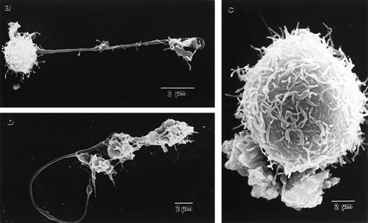 Fig. 3. Scanning electron micrographs of p45 NF-E2+/+ (a), p45 NF-E2+/− (b), and p45 NF-E2−/− (c) cultured megakaryocytes, showing extension of proplatelets from within normal cells and the surface appearance of the mutant cells, which are appreciably larger in size but do not develop proplatelets. Note the long filamentous processes separating individual platelet-size particles.