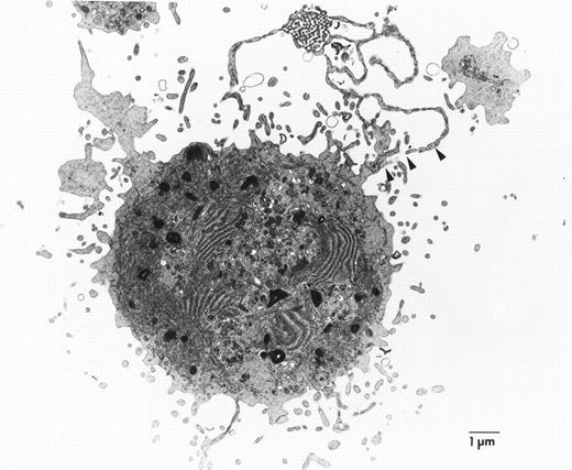 Fig. 4. Representative transmission electron micrograph of cultured p45 NF-E2+/− megakaryocytes, showing the proplatelet (arrowheads) as an extension of the cytoplasm. Ultrastructural analysis of numerous p45 NF-E2−/−megakaryocytes failed to show these structures.