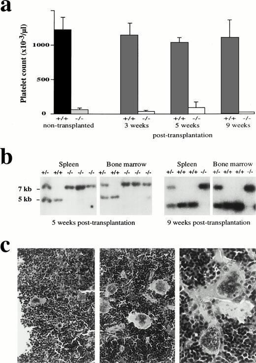 Fig. 6. Cell-autonomous thrombocytopenia in mice lacking NF-E2 function. (a) Platelet counts from adult mice of the indicated p45 NF-E2 genotype (left 2 bars, dark shading) are reproduced after fetal liver cell transplantation. Lethally irradiated wild-type recipients were transplanted with fetal liver cells from p45 NF-E2+/+ or NF-E2−/− mice and hematologic profiles followed for 3 to 9 weeks. Severe thrombocytopenia is evident in recipients of p45 NF-E2−/− transplants. (b) Southern blot analysis of hematopoietic tissues from representative fetal liver transplant recipients verifies reconstitution in these animals by cells of the transplanted genotype. The wild-type allele is represented by a 5-kb band, and the knockout allele is represented by a 7-kb band. (c) Hematoxylin and eosin-stained microscopic sections of the spleen from representative recipient mice reconstituted with fetal liver cells from wild-type (left panel) or p45 NF-E2−/−(right 2 panels) donors. The numbers and morphology of the megakaryocytes are similar to those seen in adults of the donor genotypes. Original magnifications: for left two panels, ×40; for right panel, ×100.