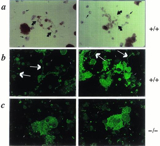Fig. 2. Staining of cytocentrifuge preparations of wild-type (a and b; +/+) and NF-E2-null (c; −/−) cultured megakaryocytes to show cytoplasmic acetylcholinesterase activity (a) and immunoreactivity with rabbit antimouse platelet antiserum (b and c). Proplatelets, indicated by the large arrows in (a) and (b), are hence shown to represent extensions of the megakaryocyte cytoplasm and membranes in wild-type cells and are not detected in the mutant megakaryocytes. Background staining of nonmegakaryocytic cells (short open bars) in (b) and (c) and absence of cholinesterase staining in granulocytes and monocytes (short straight arrows) in (a) provide internal controls for the antiserum and enzyme staining, respectively. Original magnification × 200.