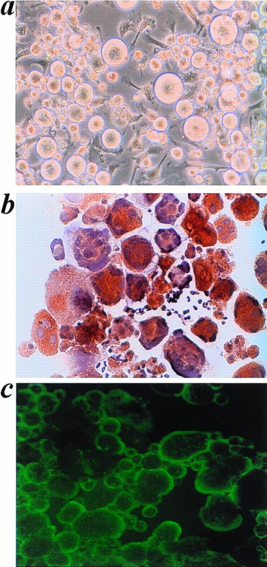 Fig. 5. GATA-1–deficient megakaryocytes. Phase-contrast micrograph (a), acetylcholinesterase staining (b), and indirect immunofluorescence with a rabbit antimouse platelet antiserum (c) each show the rarity of proplatelets among megakaryocytes cultured from GATA-1–deficient mice. Control megakaryocytes (not shown here; see Figs 1 and 2) displayed abundant proplatelets by each of these techniques. For (a), (b), and (c), original magnifications × 200.