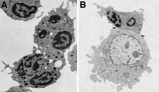 Fig. 6. Neutrophils and E3-ICAM cells observed by transmission electron microscopy. (A) Homotypic neutrophil aggregate formed 90 seconds after 1 μmol/L FMLP stimulation. (B) Neutrophil–E3-ICAM aggregate 60 seconds after FMLP stimulation. Arrow heads indicate regions of intercellular contact.
