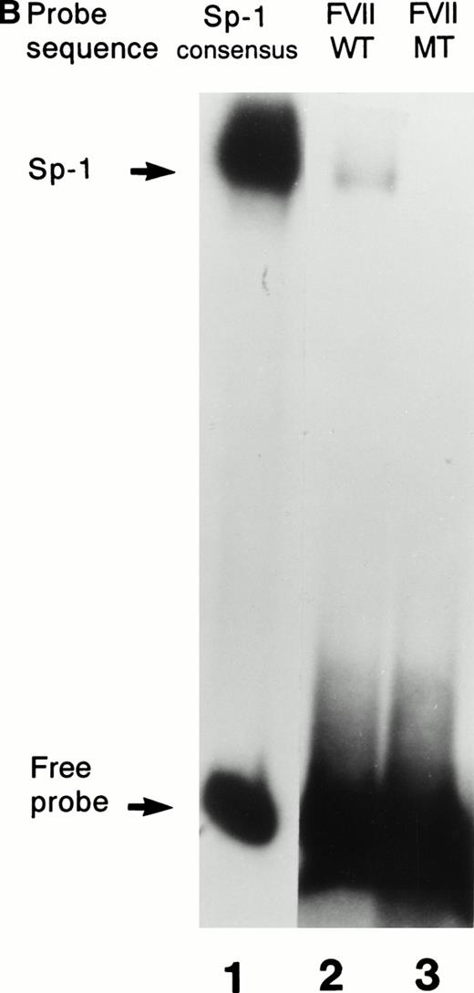 Fig. 3. Interactions with an Sp1 consensus sequence and human Sp1 protein. (A) Unlabeled wild-type (WT) but not mutant (MT94) human factor VII sequence competes for Sp1 binding with radiolabeled Sp1 consensus sequence. Lane 1 shows binding of radiolabeled Sp1 consensus probe by HeLa nuclear extract in the absence of unlabeled competitor sequences. Lanes 2 through 4 show Sp1 consensus probe binding with HeLa nuclear extract in the presence of 1,000× concentrations of unlabeled competitor Sp1 consensus sequence (lane 2), WT factor VII sequence (−108 to −84; lane 3), and MT factor VII–deficient patient sequence (−108 to −84; lane 4). (B) WT but not MT94 factor VII–deficient patient sequence binds to the transcription factor Sp1. Binding of radiolabeled oligonucleotides with recombinant human Sp1 is shown with radiolabeled Sp1 consensus sequence (lane 1) and WT factor VII sequence (lane 2) but not with MT factor VII–deficient patient sequence (lane 3).