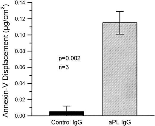 Fig. 2. Quantitative displacement of annexin-V from the PS/PC phospholipid bilayers by aPL IgG preparations in the presence of β2-GPI cofactor. The combination of aPL IgG with β2-GPI significantly displace annexin-V from the bilayers as compared with control IgG with β2-GPI. The mean (±SEM) quantity of annexin-V displaced by three different aPL syndrome patients’ IgG fractions was 0.115 ± 0.014 μg/cm2 as compared with no significant displacement by three different control IgG preparations (0.005 ± 0.007 μg/cm2, P = .002). These data demonstrate the displacement of annexin-V from the phospholipid bilayer surface by aPL IgG in the presence of β2-GPI.