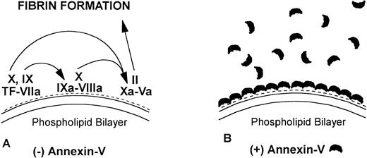 Fig. 8. Model for mechanisms of the “lupus anticoagulant effect” and the inhibition of annexin-V and acceleration of coagulation by antiphospholipid antibodies. (A) Anionic phospholipids (negative charges), when exposed on the apical surface of the cell membrane bilayer, serve as potent cofactors for the assembly of three different coagulation complexes: the tissue factor (TF)-VIIa complex, the IXa-VIIIacomplex and the Xa-Va complex, and thereby accelerating blood coagulation. The TF complexes yield either factor IXa or factor Xa, the IXa complex yields factor Xa, and the Xa formed from both of these reactions is the active enzyme in the prothrombinase complex, which yields factor IIa (thrombin), which in turn cleaves fibrinogen to form fibrin. (B) Annexin-V, in the absence of aPL antibodies, forms clusters, which bind with high affinity to the anionic phospholipid surface and shield the surface from the assembly of the phospholipid-dependent coagulation complexes, thereby inhibiting coagulation reactions. (C) In the absence of annexin-V, aPL antibodies can prolong the coagulation times, compared with control antibodies, by reducing the access of coagulation factors to anionic phospholipids. This may result in a “lupus anticoagulation effect.” (D) In the presence of annexin-V, antiphospholipid antibodies, either directly or via interaction with protein-phospholipid cofactors, disrupt the ability of annexin-V to cluster on the phospholipid surface, resulting in a net increase of the amount of anionic phospholipid available for promoting coagulation reactions. This manifests in the net acceleration of coagulation in vitro and in thrombophilia in vivo.