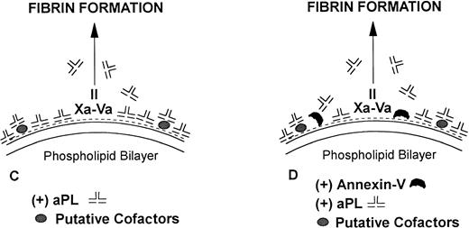 Fig. 8. Model for mechanisms of the “lupus anticoagulant effect” and the inhibition of annexin-V and acceleration of coagulation by antiphospholipid antibodies. (A) Anionic phospholipids (negative charges), when exposed on the apical surface of the cell membrane bilayer, serve as potent cofactors for the assembly of three different coagulation complexes: the tissue factor (TF)-VIIa complex, the IXa-VIIIacomplex and the Xa-Va complex, and thereby accelerating blood coagulation. The TF complexes yield either factor IXa or factor Xa, the IXa complex yields factor Xa, and the Xa formed from both of these reactions is the active enzyme in the prothrombinase complex, which yields factor IIa (thrombin), which in turn cleaves fibrinogen to form fibrin. (B) Annexin-V, in the absence of aPL antibodies, forms clusters, which bind with high affinity to the anionic phospholipid surface and shield the surface from the assembly of the phospholipid-dependent coagulation complexes, thereby inhibiting coagulation reactions. (C) In the absence of annexin-V, aPL antibodies can prolong the coagulation times, compared with control antibodies, by reducing the access of coagulation factors to anionic phospholipids. This may result in a “lupus anticoagulation effect.” (D) In the presence of annexin-V, antiphospholipid antibodies, either directly or via interaction with protein-phospholipid cofactors, disrupt the ability of annexin-V to cluster on the phospholipid surface, resulting in a net increase of the amount of anionic phospholipid available for promoting coagulation reactions. This manifests in the net acceleration of coagulation in vitro and in thrombophilia in vivo.