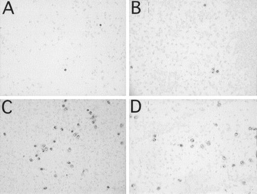 Fig. 4. Binding of leukocytes and platelets to PVC microscope slides identified by immunochemical staining after incubation of 1 mL of whole blood containing 3 IU of heparin/mL in the microscope slide model. (A and C) represent CD11b+ leukocytes. (B and D) represent CD16+ PMNs. Panels (A and B) are experiments with 250 μmol/L Compstatin and (C and D) with the same concentration of control peptide.