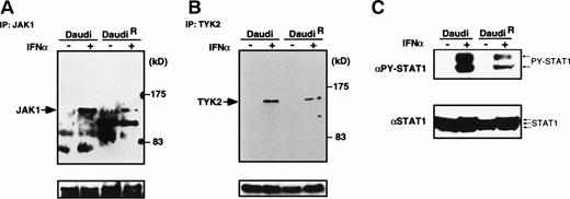 Fig. 9. IFN-–induced tyrosine phosphorylation of JAK1, Tyk2, and STAT1 in Daudi and its IFN-resistant clone. Parental Daudi cells (Daudi) or IFN-resistant cells (DaudiR) were stimulated with IFN- (1,000 IU/mL) for 15 minutes and lysed. The postnuclear supernatants were immunoprecipitated with anti-JAK1 (A) or anti-Tyk2 (B). The immunoprecipitates were blotted with antiphosphotyrosine antibody (upper panels), then the membrane was stripped and reprobed with anti-JAK1 (A) or anti-Tyk2 (B) antibodies (lower panels). (C) Total cell extracts were also blotted with anti-phospho STAT1 (PY-STAT1) and anti-STAT1 (STAT1).