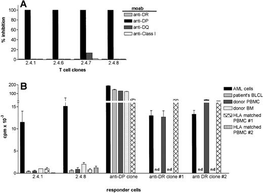 Fig. 4. HLA-restriction and the target cell specificity of leukemia reactive T-cell clones 2.4.1 and 2.4.8. (A) MoAbs against HLA-DR (B.8.11.2), -DP( B7/21), -DQ(SPV.L3) and HLA class I (W6/32) were added in the proliferation assays at a final dilution of 1:200. The results are expressed as % inhibition of the proliferative response in the absence of antibodies. (B) The proliferative response of HLA-DP–restricted T-cell clones, 2.4.1 and 2.4.8, against leukemic cells and nonleukemic cells. The data represent the summary of eight independent experiments. HLA-DPB1*1301–specific and HLA-DRB1*1302–specific T-cell clones were used as control. Besides patients’ EBV-LCL, autologous BM, and PBMC, two HLA-DP and DR-matched PBMC from unrelated donors were tested as stimulator cells.